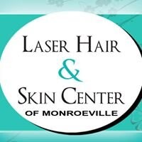 Laser hair and skin center of monroeville