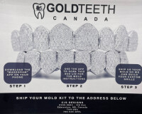 Gold teeth canada (canadian diamond boyz)